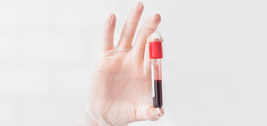 General Wellbeing At-Home Blood Test